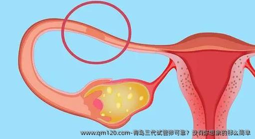 青岛三代试管卵可靠？没有你想象的那么简单