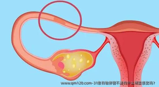 31患有输卵管不通有什么明显感觉吗？