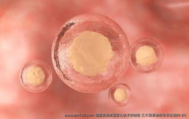 揭露美国试管婴儿技术的秘密 三大因素使成功率达到89.8%