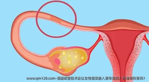 美国试管技术会让女性提前进入更年期吗？对身体有害吗？