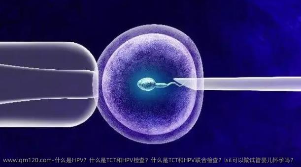 什么是HPV？什么是TCT和HPV检查？什么是TCT和HPV联合检查？lsil可以做试管婴儿怀孕吗？