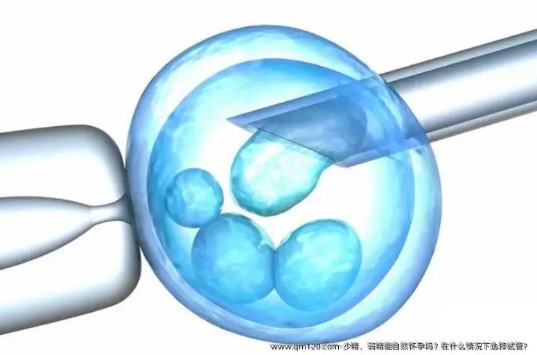 少精、弱精能自然怀孕吗？在什么情况下选择试管？