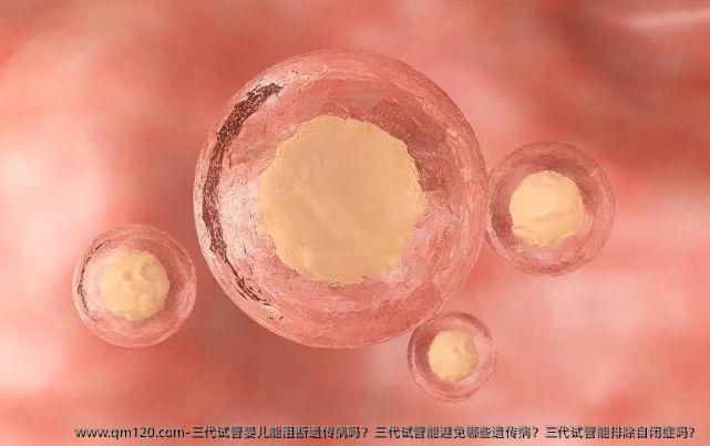 三代试管婴儿能阻断遗传病吗？三代试管能避免哪些遗传病？三代试管能排除自闭症吗？