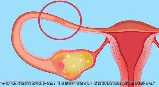 如何应对破防的空卵泡综合征？什么是空卵泡综合征？试管婴儿应该如何避免空卵泡综合征？