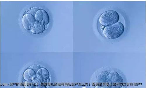 流产的原因是什么？试管婴儿胚胎移植后流产怎么办？泰国试管婴儿如何应对女性流产？