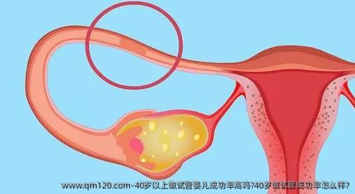 40岁以上做试管婴儿成功率高吗?40岁做试管成功率怎么样?