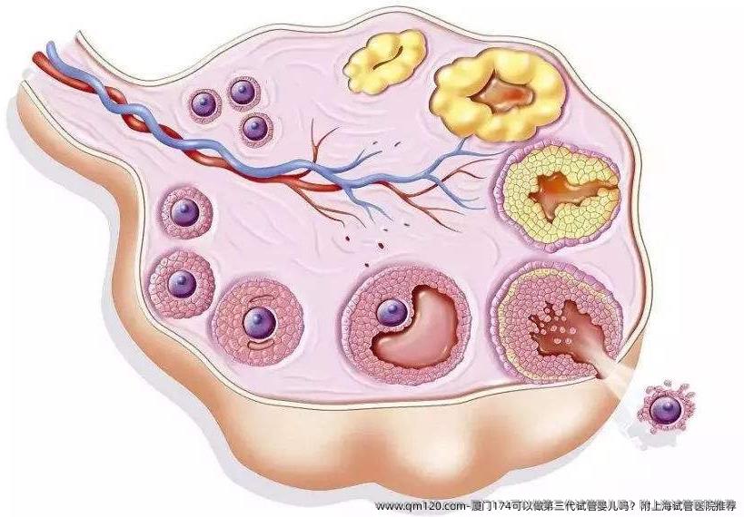 厦门174可以做第三代试管婴儿吗？附上海试管医院推荐