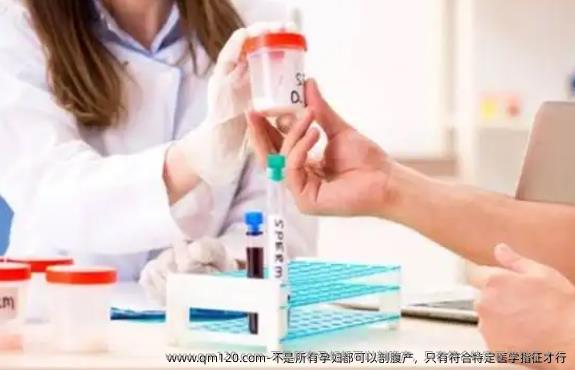 不是所有孕妇都可以剖腹产，只有符合特定医学指征才行