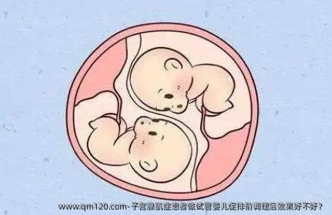 子宫腺肌症患者做试管婴儿促排前调理后效果好不好？