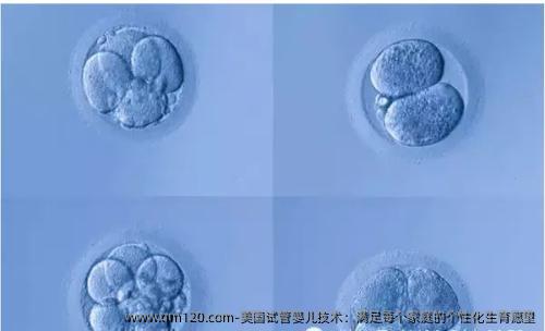 美国试管婴儿技术：满足每个家庭的个性化生育愿望