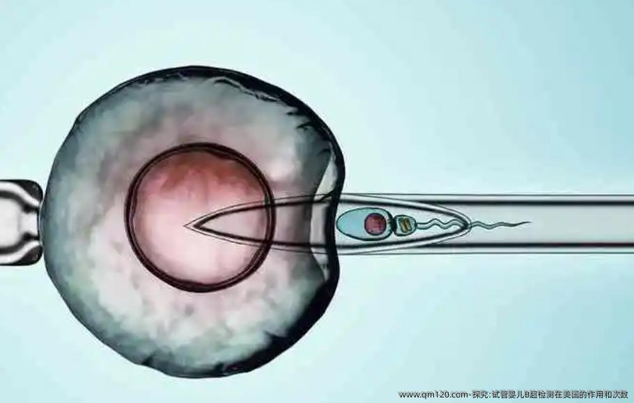 探究:试管婴儿B超检测在美国的作用和次数