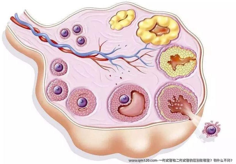 一代试管和二代试管的区别在哪里？有什么不同？