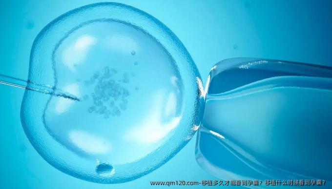 移植多久才能看到孕囊？移植什么时候看到孕囊？