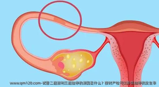 试管二超顺利三超胎停的原因是什么？按时产检可以降低胎停的发生率