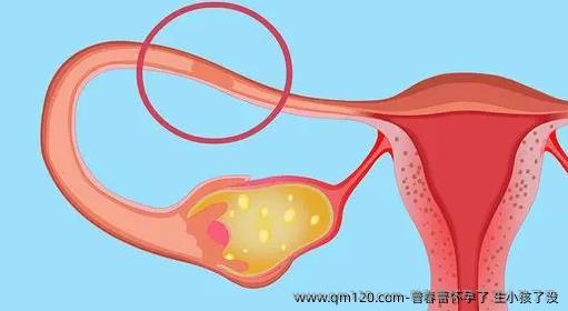 曾春蕾怀孕了 生小孩了没