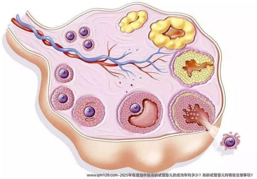 2025年在恩施市做高龄试管婴儿的成功率有多少？高龄试管婴儿有哪些注意事项？