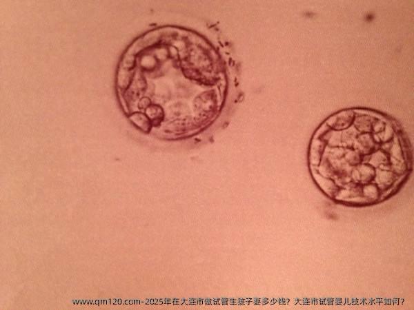 2025年在大连市做试管生孩子要多少钱？大连市试管婴儿技术水平如何？