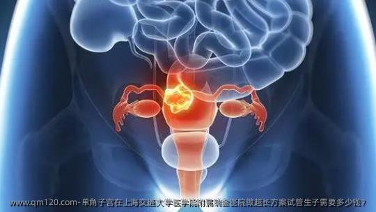 单角子宫在上海交通大学医学院附属瑞金医院做超长方案试管生子需要多少钱？