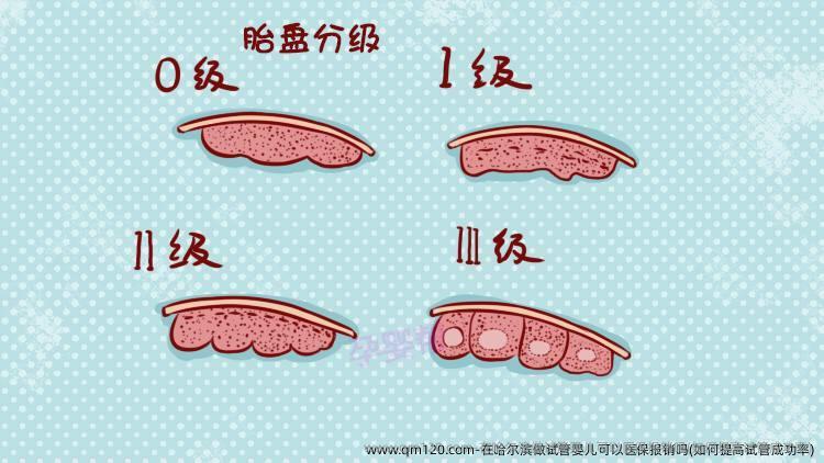 在哈尔滨做试管婴儿可以医保报销吗(如何提高试管成功率)