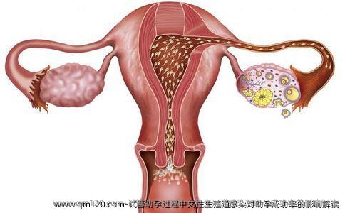 试管助孕过程中女性生殖道感染对助孕成功率的影响解读