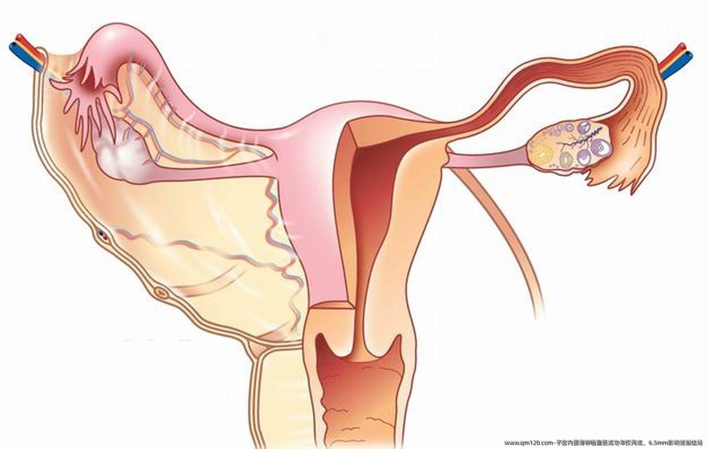 子宫内膜薄移植囊胚成功率仅两成，6.5mm影响妊娠结局