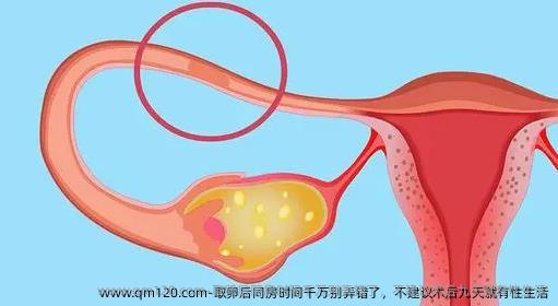 卵泡取出后同房时间千万别弄错了，不建议术后九天就有性生活