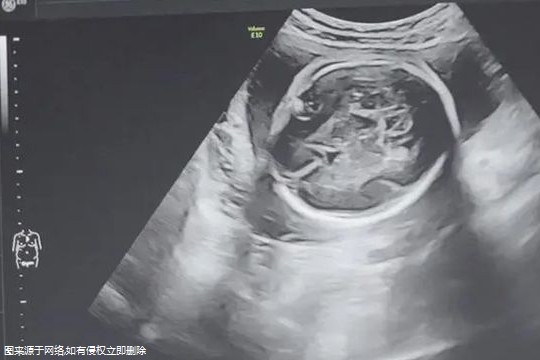 2024年在武汉私立生殖医院做试管生宝宝准备多少钱够？