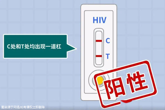 男方hiv阳性女方阴性已怀孕