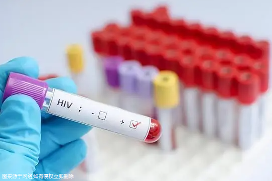 哪些国家支持hiv洗精术？