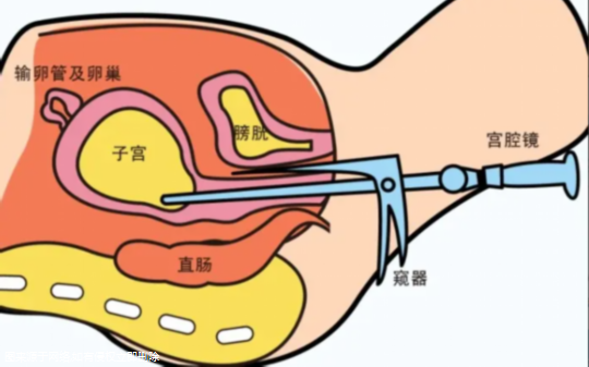 长沙无卵做试管费用，准备5万元够不够看完明白