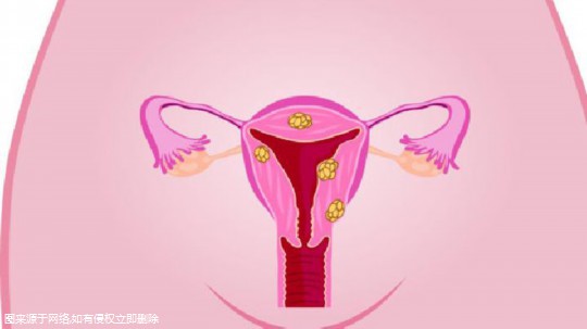 宫腔粘连术后一年还没怀孕怎么办？