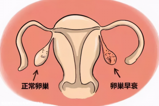 卵巢功能衰退会影响做试管吗？女卵巢功能衰退会影响做试管吗？