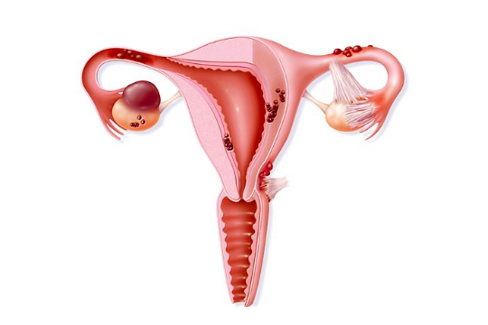 卵巢畸胎瘤能不能怀孕？