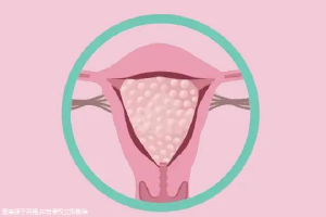 子宫腺肌症用什么试管方案？子宫腺肌症用什么试管方案比较好？