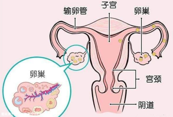 幼稚子宫加多囊卵巢要怎么治疗？