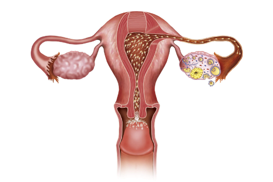 卵巢功能下降会影响试管吗？卵巢功能下降会影响移植吗？