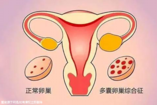 腺肌症曾经怀孕过试管成功率高吗