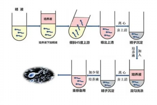 老公精子活力低做试管几代好