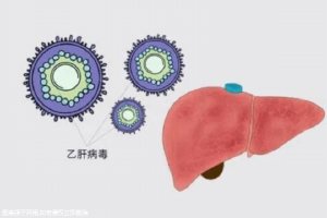 试管检查出乙肝医生会告知吗 有乙肝做试管会被歧视吗