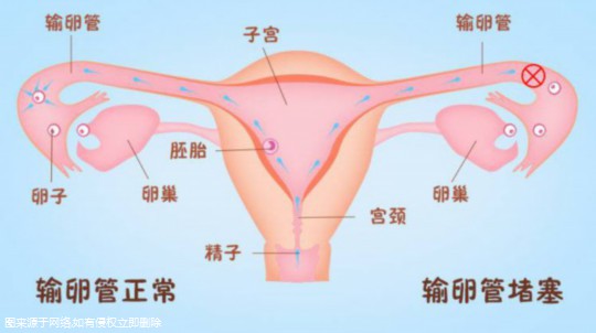 产后不正常颜色恶露图，三种变化反映恢复情况