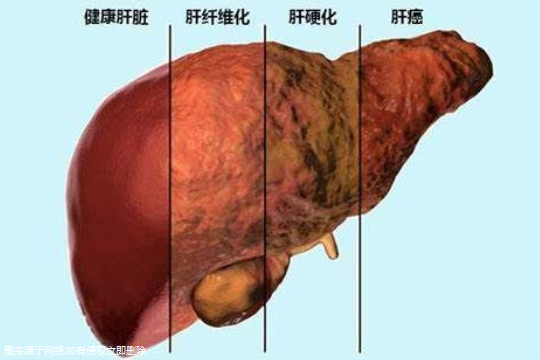 做试管为什么要查乙肝五项？做试管为什么要查乙肝五项呢？