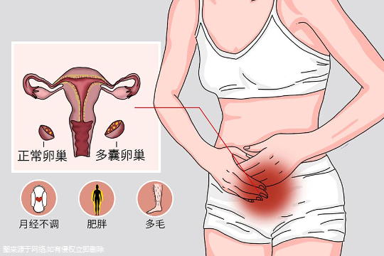 宫腔内有钙化灶能做试管吗 宫腔内钙化点影响生育吗