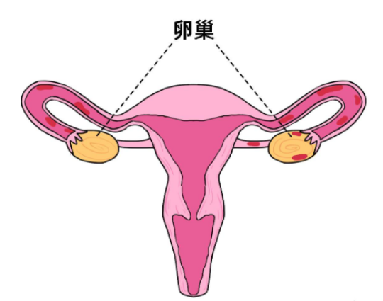 有盆腔炎内异症能做试管吗-盆腔炎导致的不孕可以做试管吗