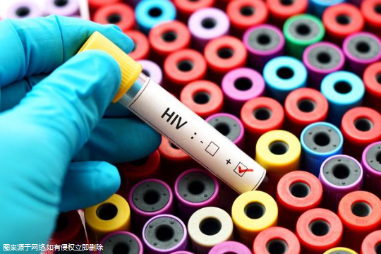 试管婴儿HIV检查的是什么-试管检查艾滋病吗