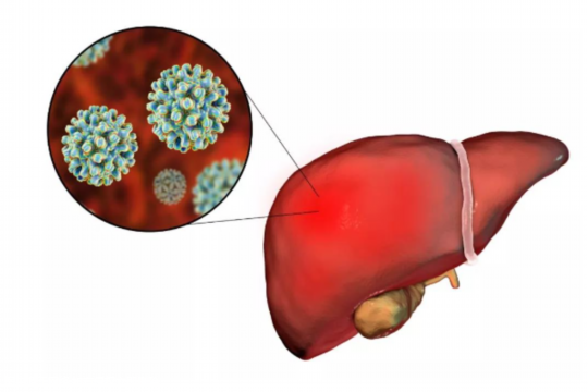 乙肝试管移植肝功能不正常
