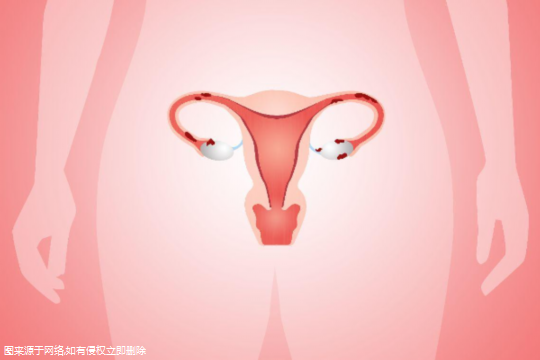 重度子宫内膜炎试管成功率有多大-重度子宫内膜炎影响怀孕吗