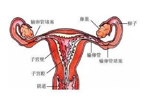 宫颈轻糜可以做试管吗