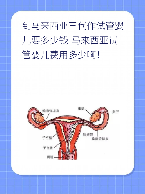 到马来西亚三代作试管婴儿要多少钱-马来西亚试管婴儿费用多少啊！