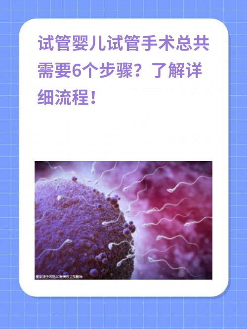 试管婴儿手术总共需要6个步骤？了解详细流程！