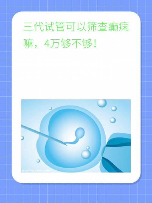 三代试管可以筛查癫痫嘛，4万够不够！